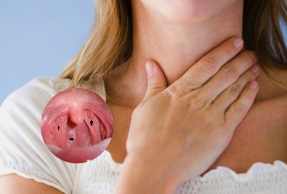 Ung thư vòm họng nguyên nhân dấu hiệu triệu chứng phương pháp điều trị hiệu quả nhất (1)